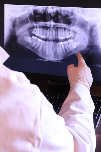 Best Dentist for Tooth Abscess  in Arp, TX