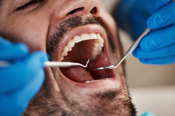 Best Broken Tooth Emergency  in Arp, TX